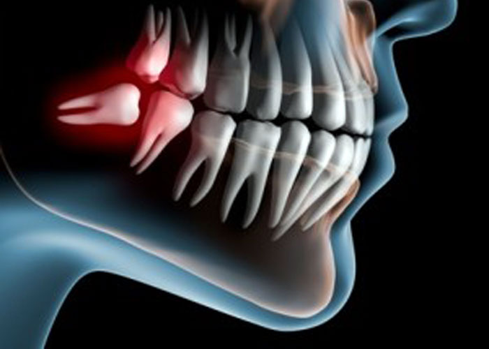 digital x-ray